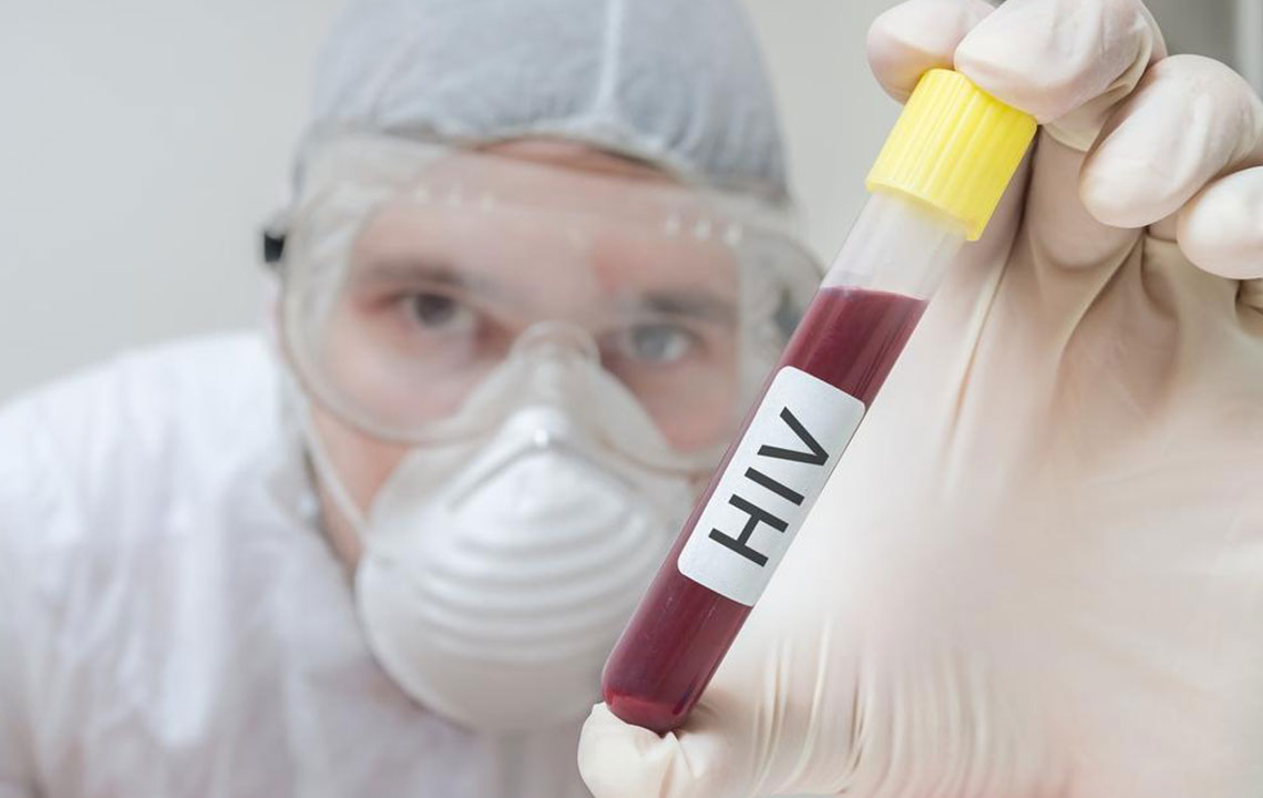 HIV/AIDS Diagnosis – Proper Treatment Starts with Proper Diagnosis