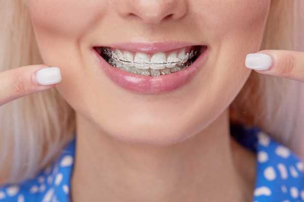 Affordable Braces and Teeth Straightening in the UK (2025 Update)
