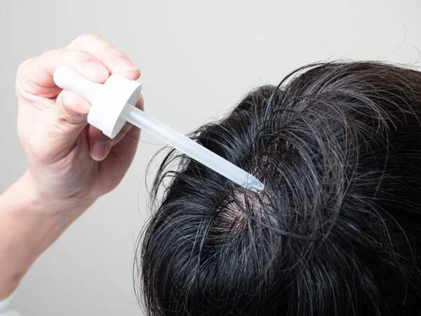 育毛ケア：日本人の薄毛・抜け毛を改善する科学的メソッドと生活習慣見直し